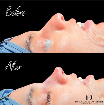 Slider image (5) Dr. Ignacio De Las Fuentes